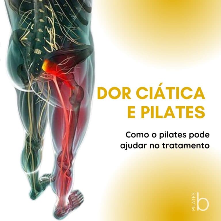 Illustration of the sciatic nerve along the leg
